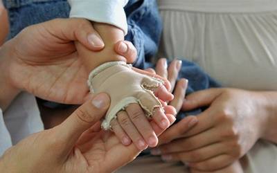 atención-por-quemaduras