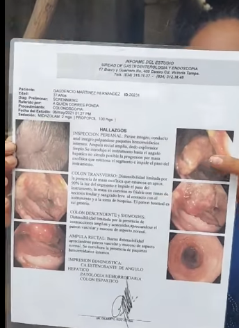 Muestra sus complicaciones