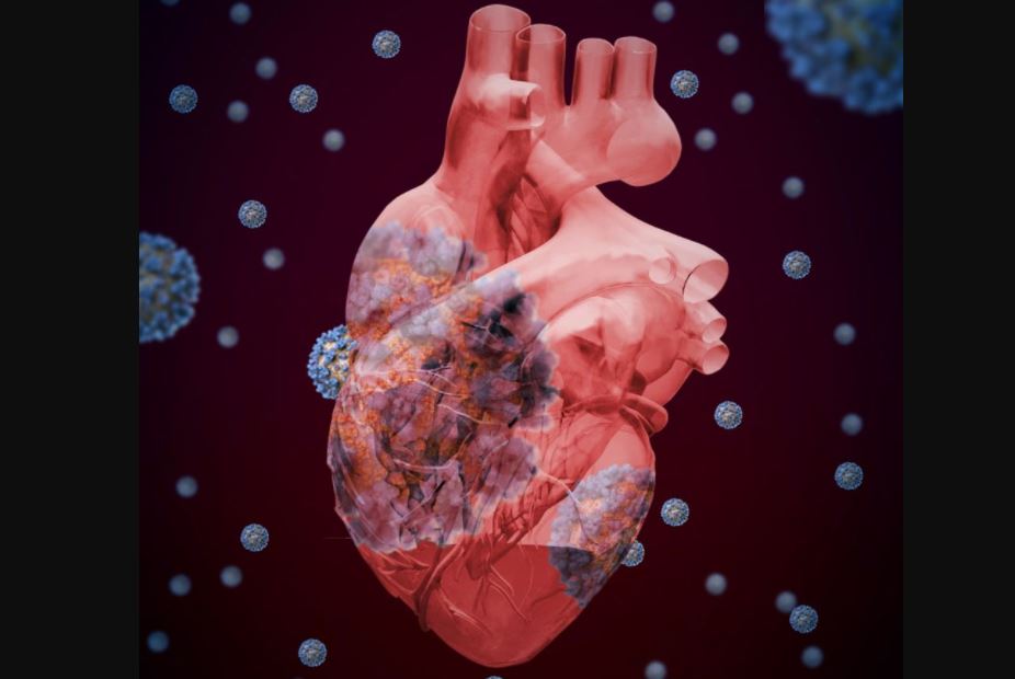 Principales causas de muerte en México durante 2020