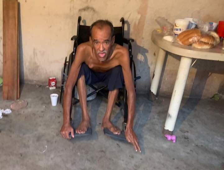 Don Pedro tiene cáncer de mama y pide ayuda