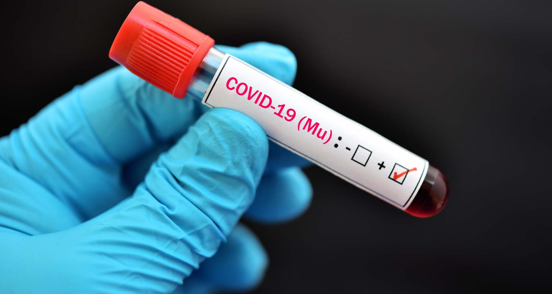 El subsecretario de Salud, Hugo López-Gatell confirmó que la variante Mu del virus Sars-CoV-2 ya se encuentra circulando en México.