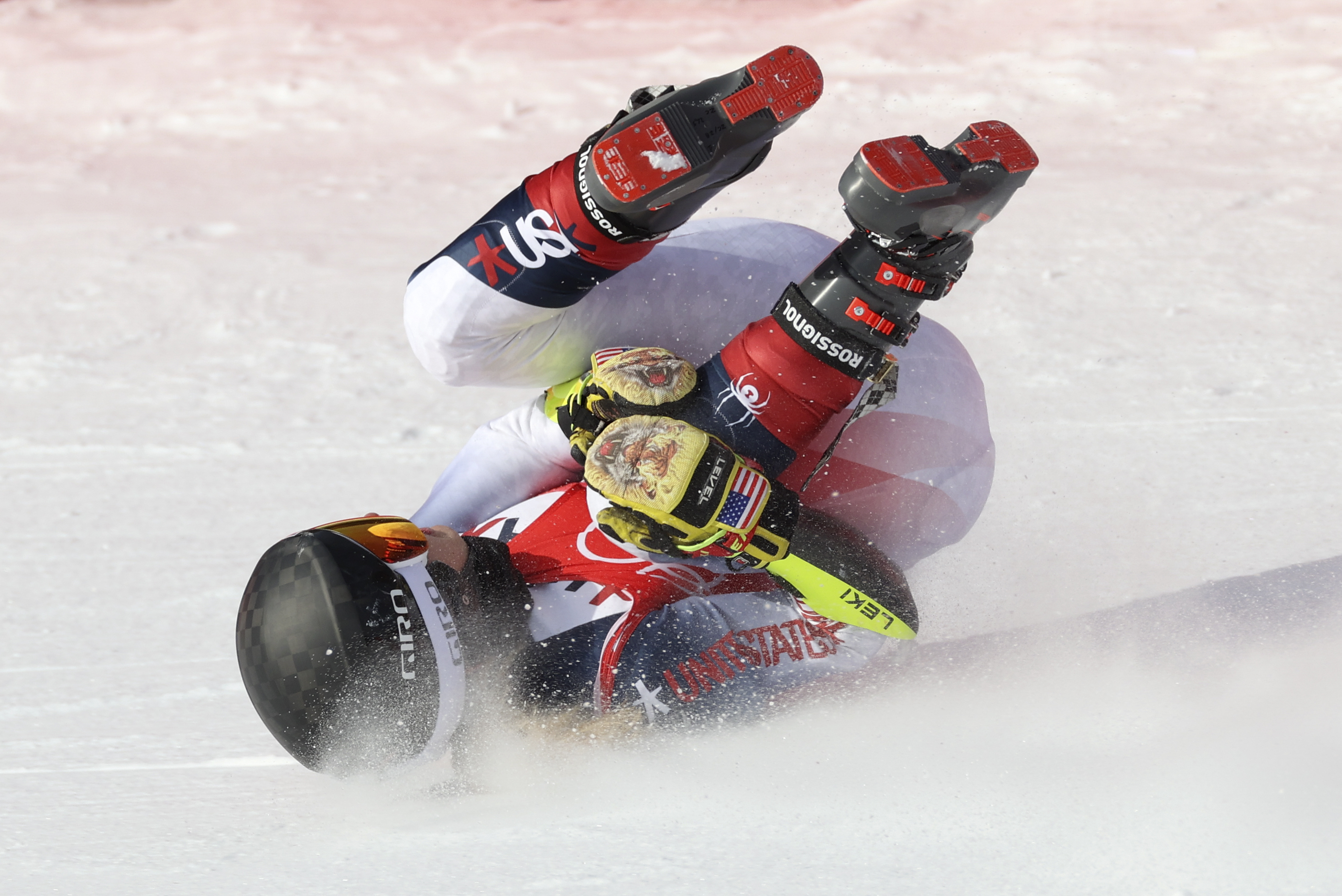 Esquiadora se fracturó la pierna en plena competencia