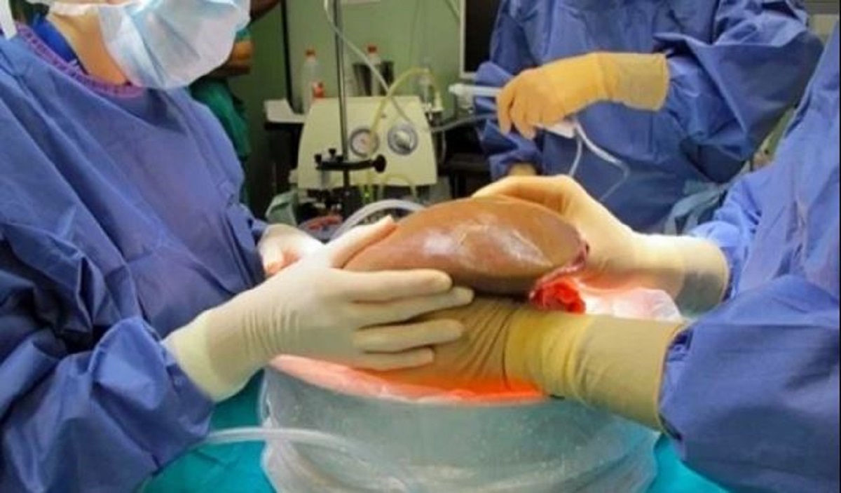 En Tamaulipas 38 personas requieren trasplantes