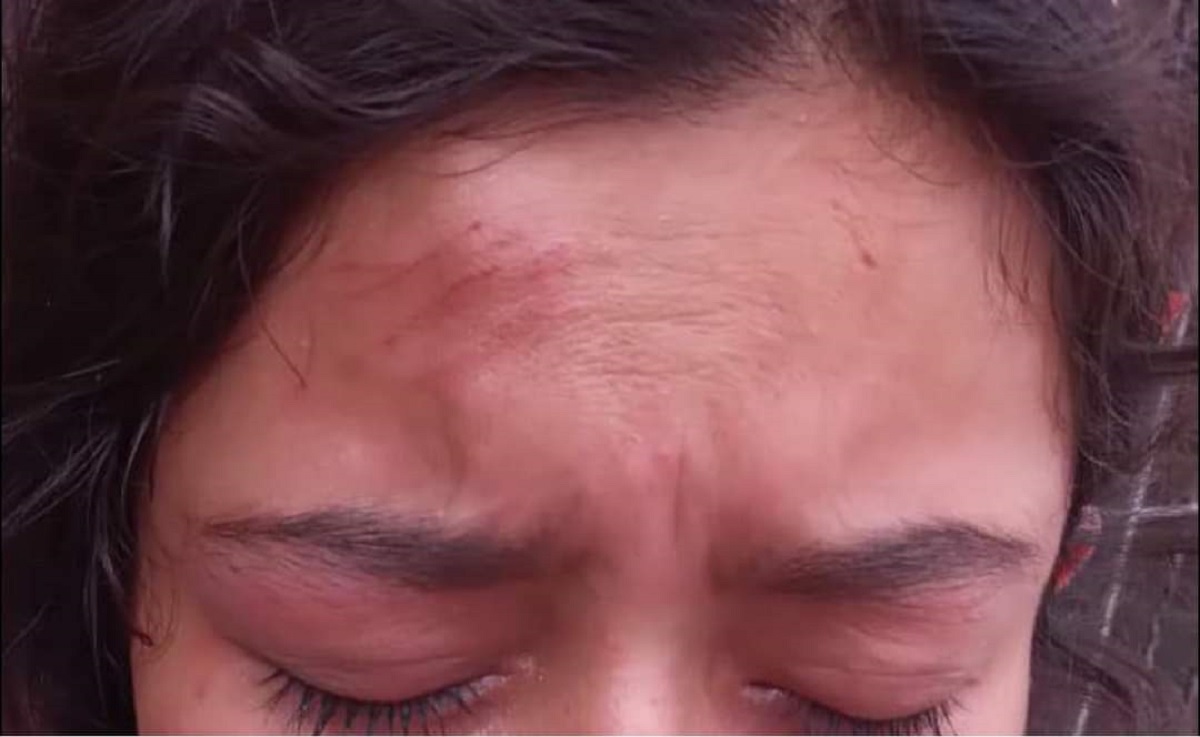 Empleada fue golpeada