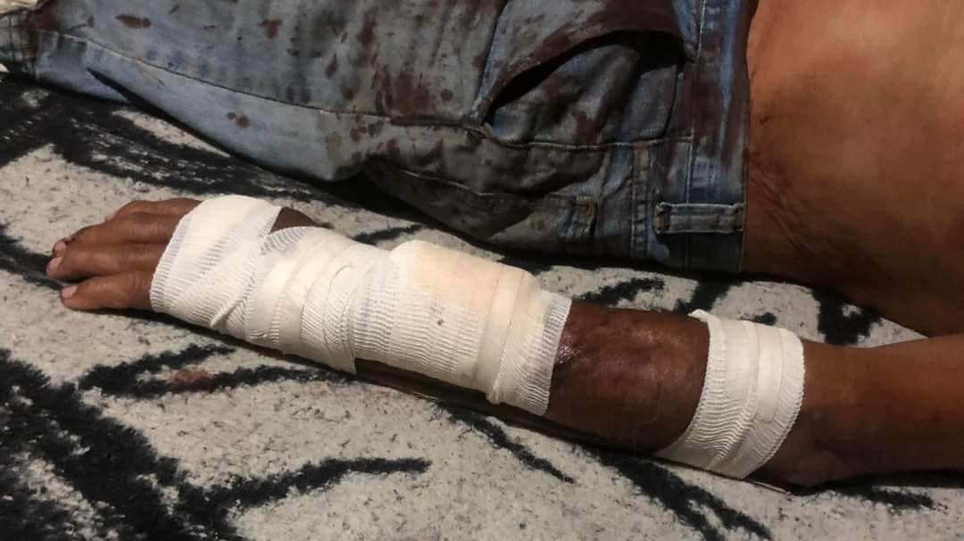 golpearon a abuelito en Altamira