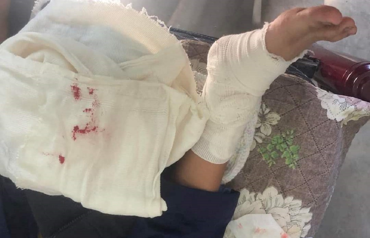 Menor fue atacado por un perro