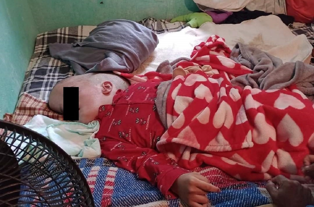 Madre de bebé con macrocefalia