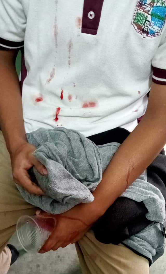 atención médica de Oliver no fue la esperada