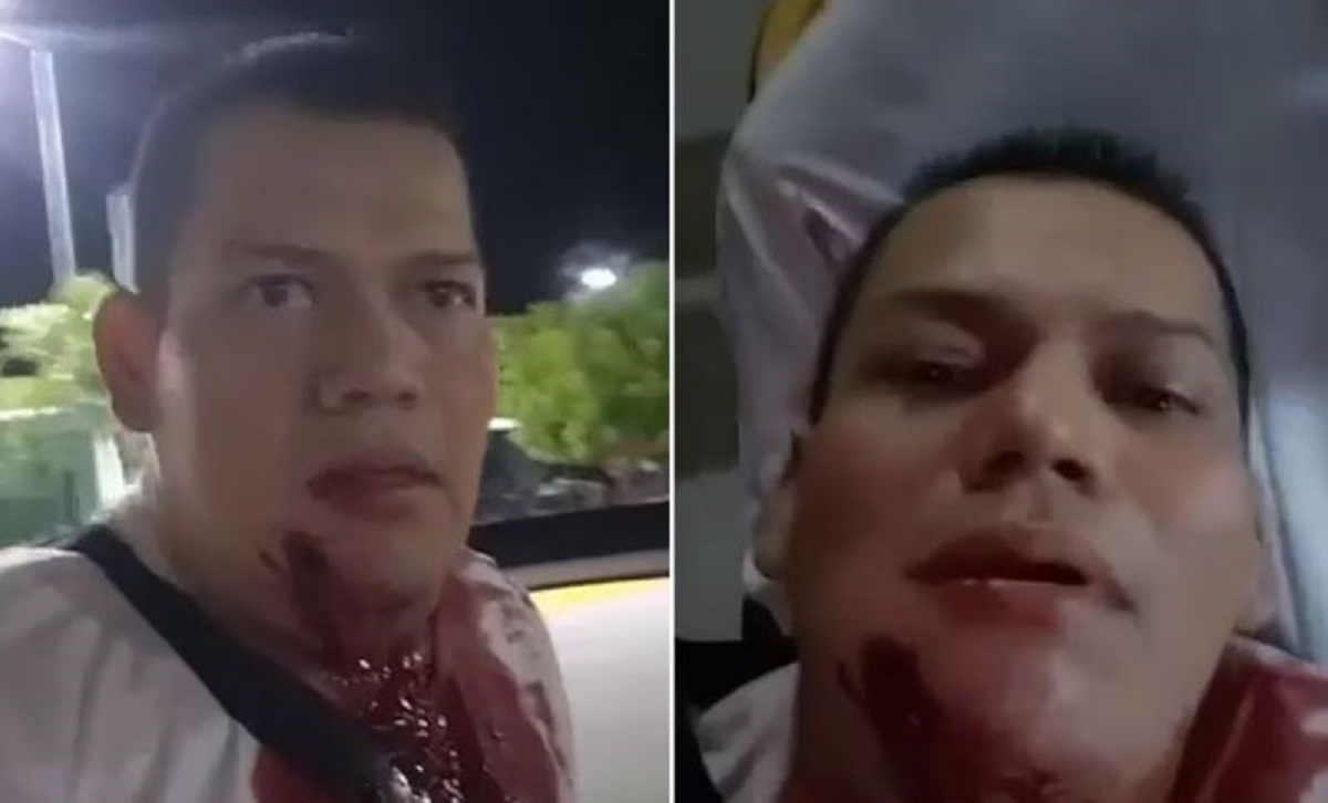 Atacan a balazos a activista